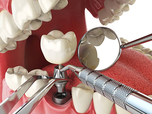 Best Emergency Tooth Extraction  in Pennside, PA